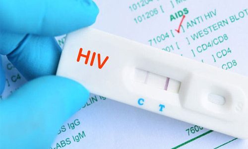 Hiệu thuốc có bán que thử hiv không? Giá bao nhiêu? Mua ở đâu 2022?