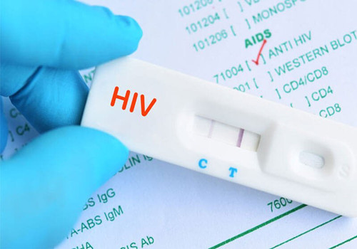 Hiệu thuốc có bán que thử hiv không? Giá bao nhiêu? Mua ở đâu 2022?